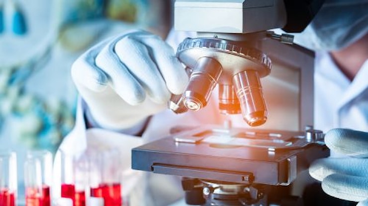 Tumori. Nuove cellule Natural Killer ingegnerizzate potrebbero superare le difese del cancro e rendere più efficace l'immunoterapia - Quotidiano Sanità