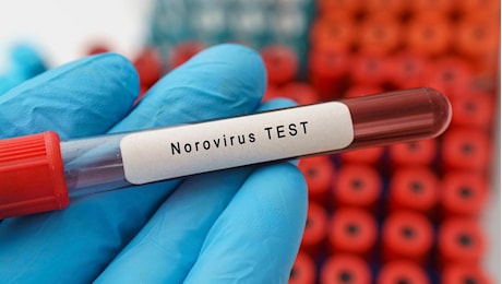 Nuovo focolaio di norovirus sulla Ruby Princess, oltre 120 passeggeri colpiti durante la crociera in Alaska