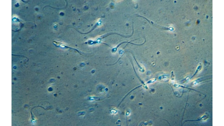 Danimarca, donatore di sperma portatore della mutazione TP53: 200 bambini a rischio cancro - Sky TG24