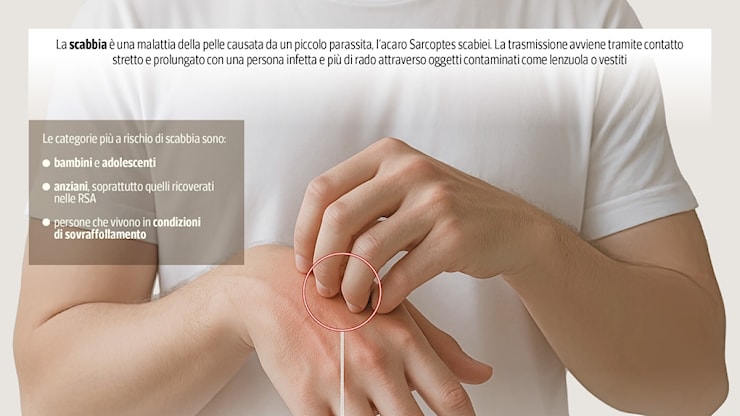 Sesto Fiorentino, 14 casi di scabbia in una Rsa: partite le procedure di contenimento - Corriere Fiorentino