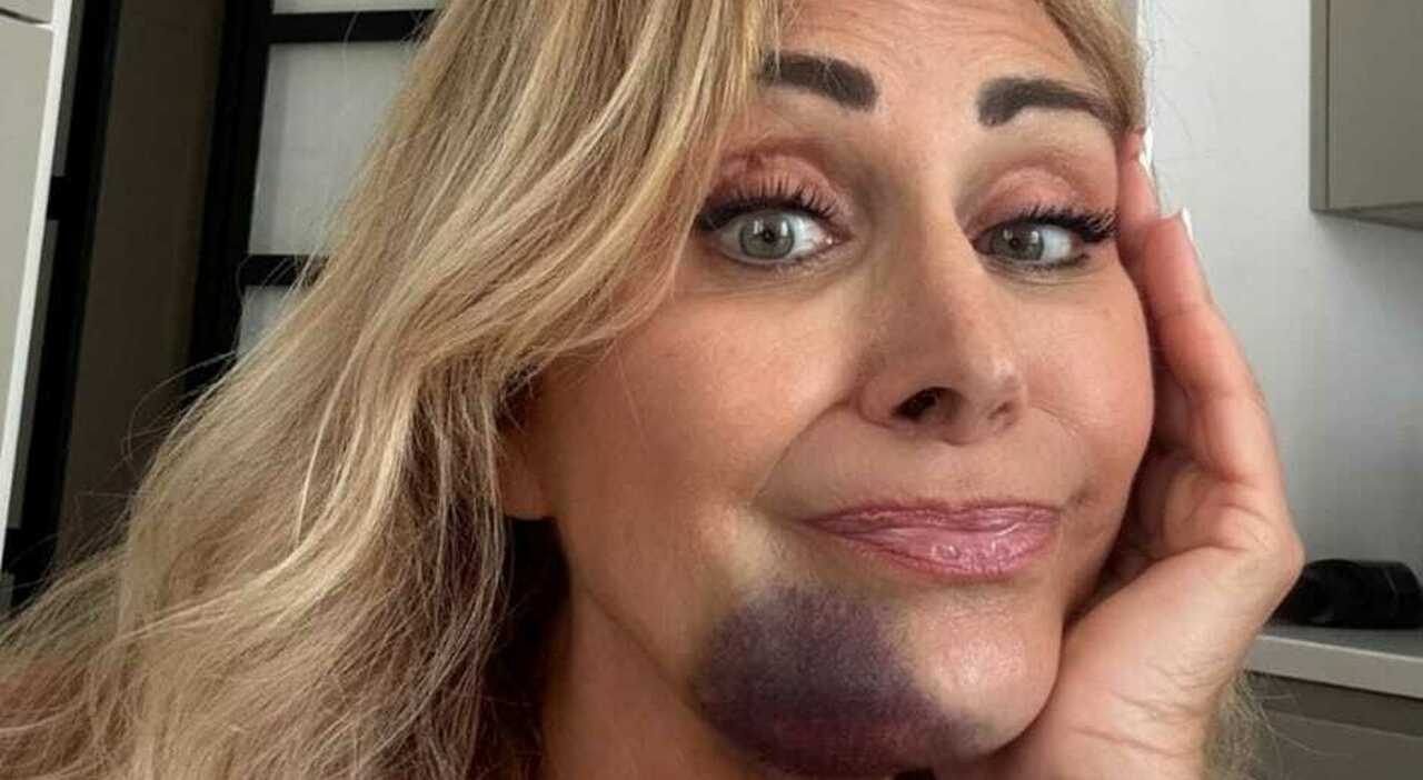 Incidente stradale per la madre di Chiara Ferragni, Marina di Guardo: «Poteva andare molto peggio»