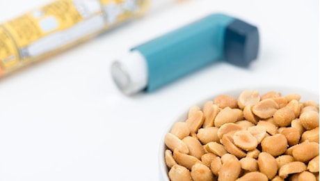 Shock anafilattico, in Italia arriva lo spray nasale di adrenalina