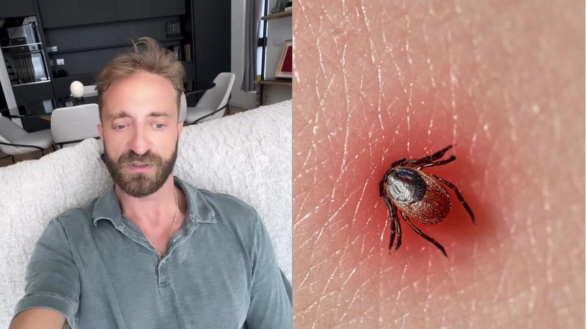 Morso da una zecca in Sud Africa, come sta Stefano Corti: “Pensavo fosse un pelo incarnito, l’infettivologa ha subito capito tutto”