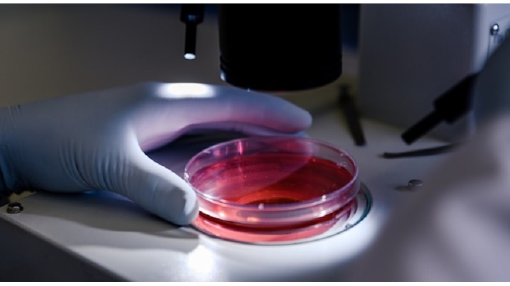 Donatore di sperma ha una mutazione genetica che aumenta il rischio di cancro, nati 200 bambini in 14 nazioni diverse: «Alcuni sono già morti» - Corriere Adriatico