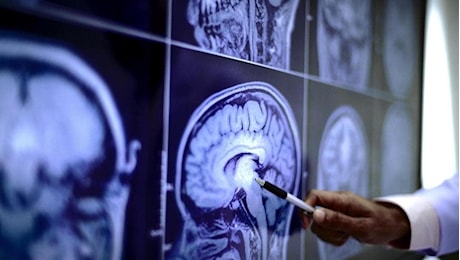 Cibi ultraprocessati, non contano solo le calorie: gli effetti su cervello e insulina