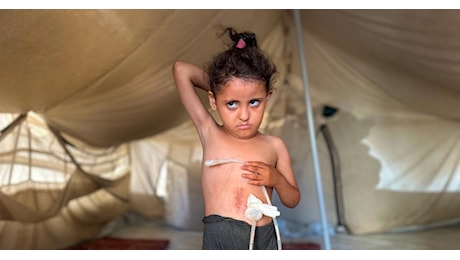 Gaza, cura interrotta: l’ostruzione esofagea e le frontiere chiuse lasciano una bambina a lottare per la sopravvivenza